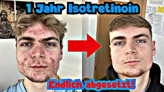 Isotretinion nach über einem Jahr abgesetzt! Ist die Akne wieder zurück?