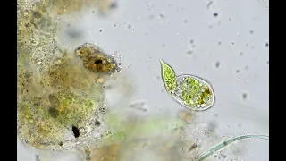 freshwater ciliate eating algae