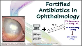 Fortified Antibiotics in Ophthalmology