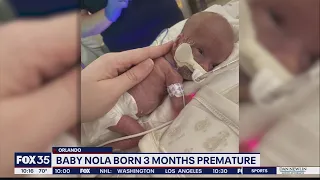 Baby Nola born 3 months premature