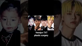Yeonjun TXT did PLASTIC SURGERY?? 🥱🤔 #kpop