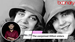 No. 19, History :  The conjoined Hilton sisters. (ISL)