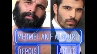 MEHMET AKIF ALAKURT - ANTES E DEPOIS DO TURCO MAIS COBIÇADO PELAS MULHERES. O "PRINCIPE DA TURQUIA".