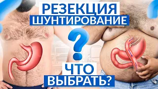 Похудеть с помощью операции: Резекция vs Шунтирование — что лучше?