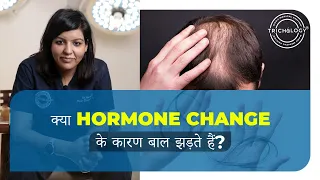 Hair Fall or Hair Loss Due To Hormonal Changes | Male vs Female Baldness Pattern