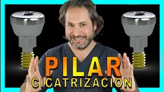 👉PILAR  de CICATRIZACION IMPLANTES♦️SEGUNDA FASE Implantes DENTALES funcion♦️