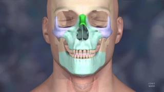 3D Printed Models Used in the Mayo Clinic's First Face Transplant