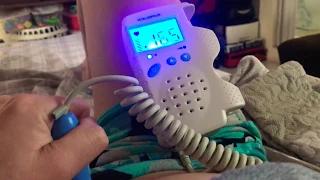 Doppler fetal 9 semanas ouvindo o coração do bebê em casa🤰🏻❤️