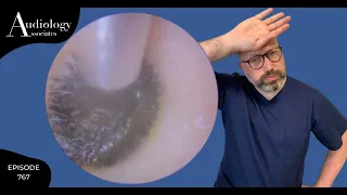 EAR WAX BOULDER /CHILDS EAR WAX REMOVAL - EP767