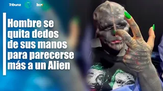 ¡IMPRESIONANTE! #VIDEO: Hombre se quita dedos de sus manos para parecerse más a un Alien⁣