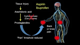 The Neuroscience of Pain: Translating Science to the Patient