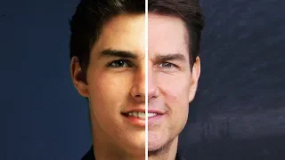 TOM CRUISE: Before and After Plastic Surgery