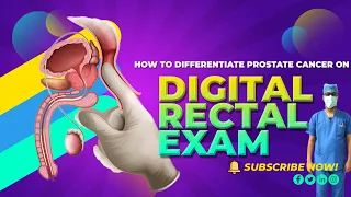 How to differentiate a PROSTATE CANCER from normal prostate on Rectal Examination?