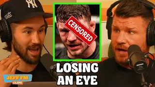 MICHAEL BISPING DETAILS THE GRUESOME STORY OF LOSING HIS EYE | JEFF FM CLIPS
