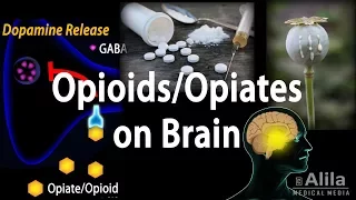 Opioids Mechanism of Action, Addiction, Dependence and Tolerance, Animation