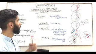 OPHTHALMOLOGY | HYPERTENSIVE RETINOPATHY