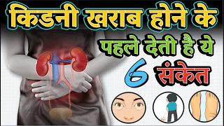 किडनी खराब होने के 6 लक्षण और इलाज | 6 Warning signs of kidney damage |