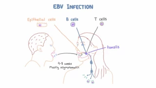 EBV and Mononucleosis - Pathogenesis and Clinical Presentation