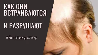 ОБЛЫСЕНИЕ из-за ТЯЖЕЛЫХ металлов! Как это работает #алопеция #синиедесна