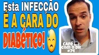 A infecção mais típica dos diabéticos, sabe qual é? | Café com o Dr ☕ #75