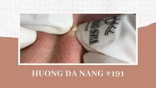 #191 | Huong Da Nang