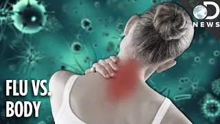 Why The Flu Causes Aches & Pains