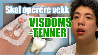 Visdomstenner Operasjon // Rasmus Vest