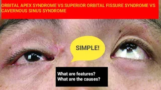 Orbital Apex vs. Superior Orbital Fissure | Cavernous Sinus Syndrome