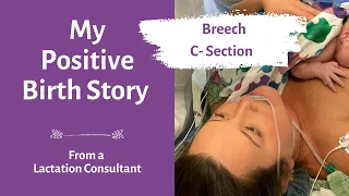 My Positive Birth Story | scheduled c section breech baby | C section recovery