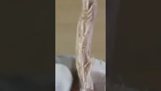 spinal nerves