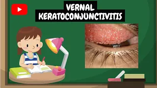 Vernal Keratoconjunctivitis | Learn with Neha
