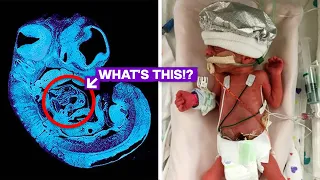 An unborn girl sends signals from the womb of her mother, and doctors discover something astonishing