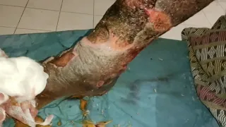 New Maggots Wound | Dead Tissue & Worms Removal Complete Video Clip