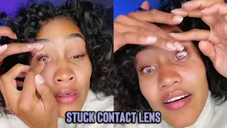 Girl's Contact Lens Got Stuck in Eyelid || WooGlobe