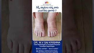 How Much Water Should Kidney Patients Drink: Explained By Dr. M. V Sai Krishna (Nephrologist)