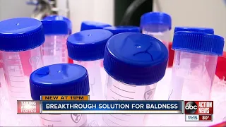 California lab creating 'cure' for baldness using cell cloning process