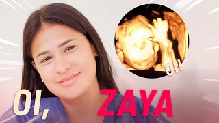 MEU EXAME DE ROTINA - Vimos o rostinho da Zaya!