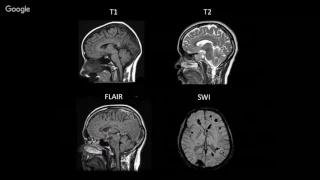 Establishing a Normative Neuroimaging Library to Support TBI Diagnosis & Management