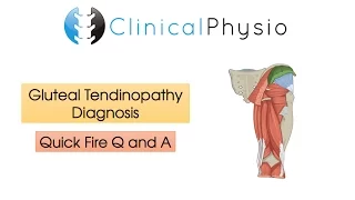 Classic Gluteal Tendinopathy Diagnosis | Clinical Physio