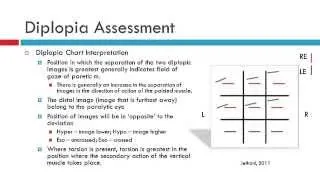 Diplopia