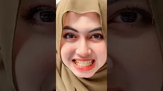 NI LA CARA ANIQ BILA FIERA MARAH 🤣