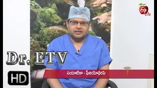 Sciatica Physiotherapy | Dr ETV | 15th June 2019 | ETV Life