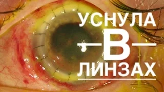 Что Если Уснуть В Линзах?