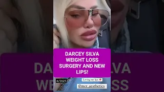 Darcey Silva gets weight loss surgery and new lips after getting the old lips dissolved #90dayfiance