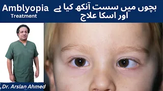 What is Amblyopia? How to Treat a Lazy Eye | Causes & Treatment in Urdu / Hindi