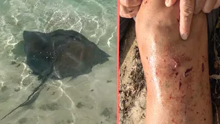 Stingrays Attack! How safe is it to swim with stingrays?