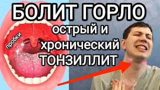 Как избавиться от гнойных пробок навсегда / Тонзиллит. Упражнения, полоскание, рекомендации