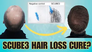 Will SCUBE3 Cure Hair Loss? WATCH NOW