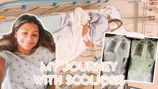 My Journey with Scoliosis // Vlogs