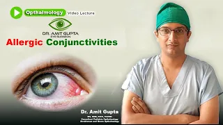 Allergic conjunctivitis | Ophthalmology | Signs and Symptoms | Diagnosis and Treatment